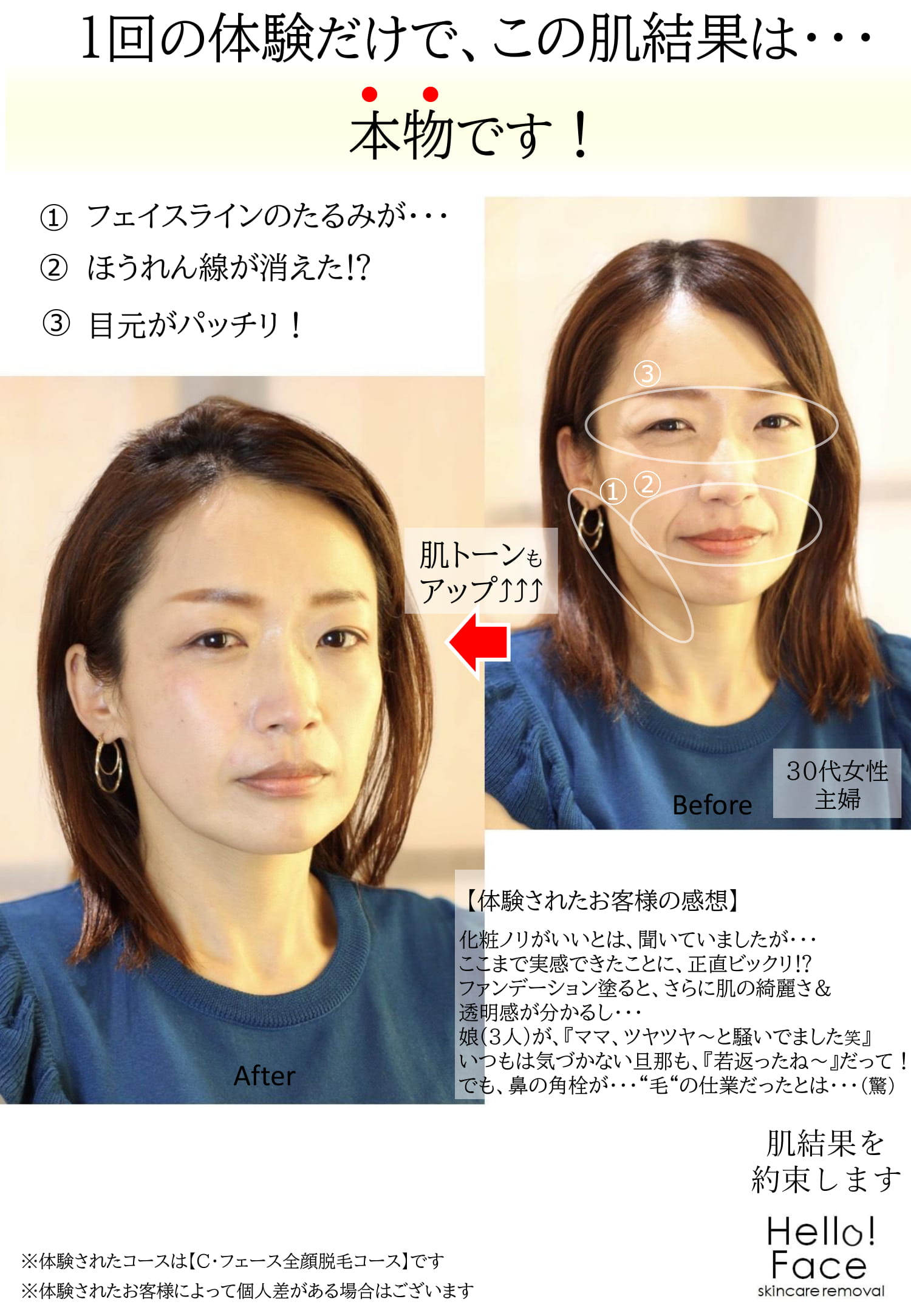 肌結果をお約束します 名古屋栄店サロンニュース Mod S Hair オフィシャルサイト ヘアサロン 美容室 美容院